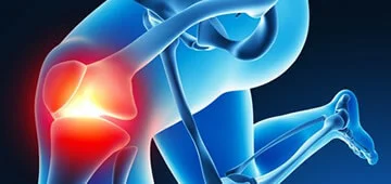 Knee Orthopedics in Guadalajara