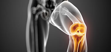 Orthopedics and knee prostheses in Guadalajara